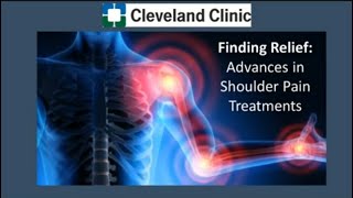 Finding Relief Advancements in Shoulder Pain Treatments [upl. by Nagram]