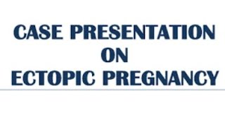 Case presentation on Ectopic pregnancy nursing obg [upl. by Ahtekal]