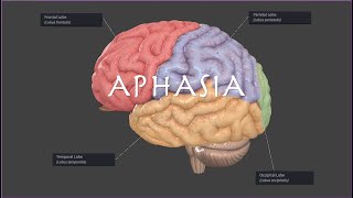 Brocas or Wernickes Aphasia on the NPTE [upl. by Eugor]