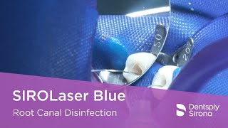 SIROLaser Blue  Root Canal Disinfection [upl. by Willette621]