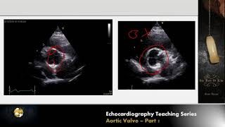 Lecture 9  Aortic Valve Part 1 [upl. by Diana]