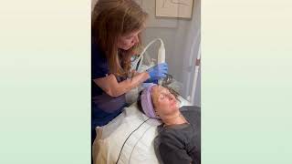 Skin Rejuvenation  Microneedling [upl. by Yllrebmik752]