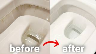 Easiest Way to Remove Yellow Toilet Stains  Works Every Time [upl. by Anselmi480]