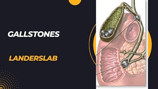 Cholelithiasis cholecystitis choledocholithiasis cholangitis pancreatitis [upl. by Ettenaej]