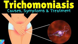 Trichomoniasis Causes Symptoms Diagnosis Treatments and prevention [upl. by Adnarom]