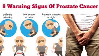 8 Signs That You Have Prostate Cancer Symptoms Prostate Cancer in Males [upl. by Ttezil997]