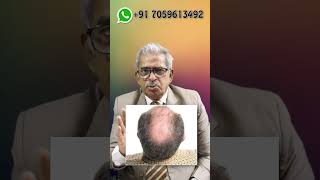 Best homeopathy medicine for Baldness  Dr P S Tiwari [upl. by Nibor]