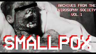 SMALLPOX  Archives from the Virosophy Society Vol 1 Analog Horror [upl. by Sauer426]