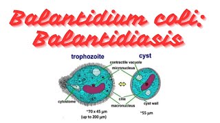 Balantidium coli Balantidiasis Clinical parasitology [upl. by Ettedualc]