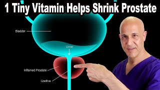 1 Tiny Vitamin Helps Shrink Your Enlarged Prostate  Dr Mandell [upl. by Vijnas]