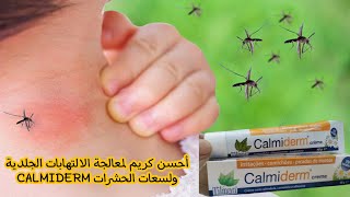 أحسن كريم لمعالجة الالتهابات الجلدية ولسعات الحشرات CALMIDERM [upl. by Kenon]