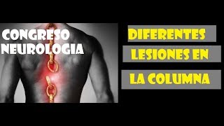 Diferentes Lesiones de la Columna Vertebral [upl. by Sirrah823]