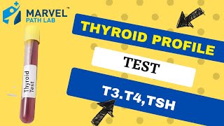 Thyroid Profile T3T4 TSH Test  Thyroid Function Test  Marvel Path Lab [upl. by Royo]