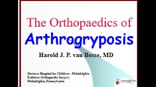 The Orthopaedics of Arthrogryposis by Dr Harold vanBosse [upl. by Alliber]