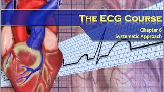 The ECG Course  Systematic Approach [upl. by Eerol842]