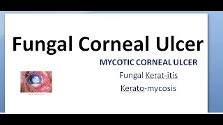 Ophthalmology 115 a Fungal Corneal Ulcer Mycotic Keratitis KeratoMycosis Eye treatment fungus anti [upl. by Aramahs881]