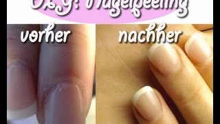 DIY Nagelpeeling gegen trockenerissige Nagelhaut in 1 min herstellen [upl. by Nymzaj500]