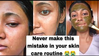 WHAT HAPPENED TO MY SKIN❗❓ NEVER Fo This Mistake 😭To Your Skin care Routine shinescapes [upl. by Lamag]