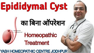 Epididymitis cyst homeopathic medicines epididymitis treatment in hindi  pain and cause [upl. by Mara]