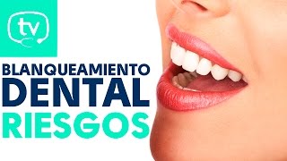 Todo sobre el blanqueamiento dental y sus riesgos [upl. by Esidarap269]