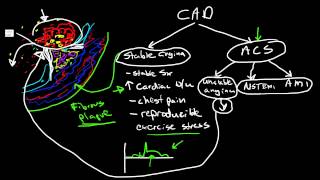 Pathophysiology of Coronary Artery Disease [upl. by Im]