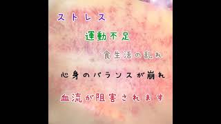 瘀血は万病の元〜カッピングやかっさで血行改善 [upl. by Dacey]