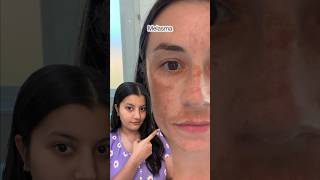 The Derma Co Tranzelaic Pigmentation Corrector Serum Review [upl. by Palumbo]