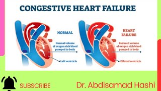 83 HEART FAILURE [upl. by Maximilian462]