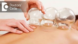 Who should avoid Hijama or Cupping Therapy  Dr Shagufta Siraj [upl. by Hasheem]