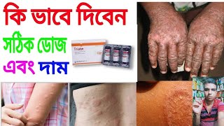 trialon ইনজেকশন এর কাজ কি full review Bangla তীব্র কাশি অ্যাজমা এলার্জি রোগে। [upl. by Marchal520]