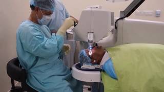 Laser Cataract Surgery by LenSx at Bangladesh Eye Hospital [upl. by Chloras]