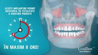 3D medical animation  Fast and Fixed dental implant [upl. by Kramlich]