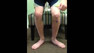 External Tibial Torsion A Video Showing its impact on the knee and foot [upl. by Aidualk]