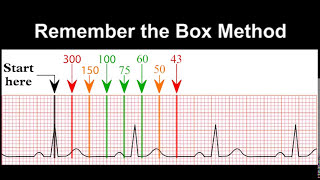 ECG Practice Test [upl. by Brittain]