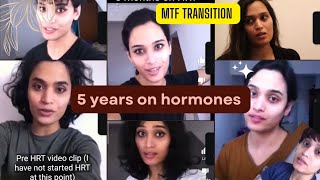 5 years MTF transition clips gendertransition [upl. by Arded]