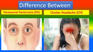 Difference Between Paroxysmal Hemicrania and Cluster Headache [upl. by Averat973]