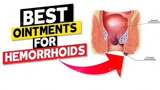 Best Ointments for Hemorrhoids [upl. by Adnavoj143]