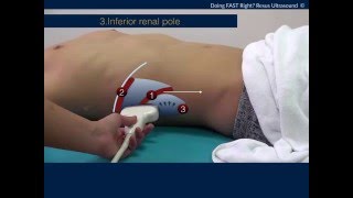 5 minute How to do FAST ultrasound like expert [upl. by Gillmore]