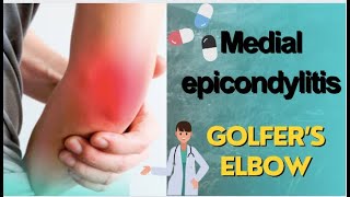 Medial Epicondylitis Clinical Evaluation diagnosis  ultrasound and Treatment Strategies [upl. by Galitea]