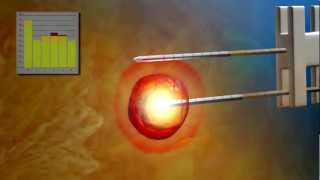 Novilase® Interstitial Laser Therapy Procedure Animation [upl. by Paz373]