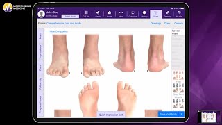 Meet Dr Holzworth amp learn about our podiatryspecific EHR EMAⓇ [upl. by Tristam]