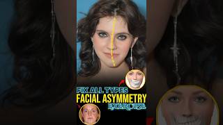 Fix Asymmetrical Face [upl. by Kyrstin]