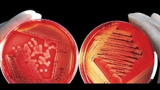 Bacteriology Part 3 Family Enterobacteriaceae Proteus Spp [upl. by Wagstaff]