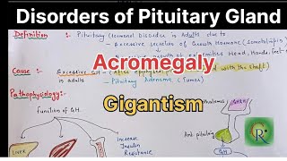 Acromegaly and Gigantism ll Pituitary Disorders [upl. by Boorman179]