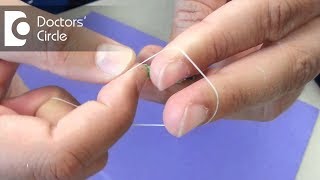 What is Rubber Band Ligation amp how is it done  Dr Nagaraj B Puttaswamy [upl. by Cliffes]