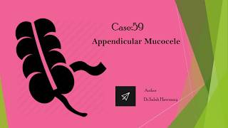 Appendicular Mucocele [upl. by Forster]