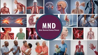 Motor Neurone Disease The Truth You Need to Know [upl. by Lleinnad]