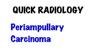 QUICK RADIOLOGY Periampullary carcinoma [upl. by Danya]