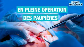 👁️ Une chirurgie pour remonter les PAUPIÈRES  Allo Docteurs [upl. by Inafit]