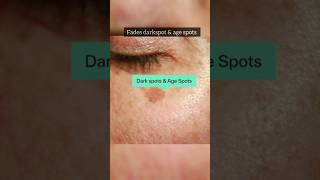 DERMATOUCH Bye Bye Pigmentation Cream reviewdarkspotsdermocosmeticspigmentationhyperpigmentation [upl. by Jacki]